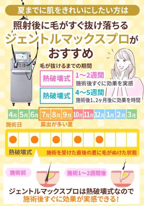 ジェントルマックスプロの脱毛の仕組みを示した図
