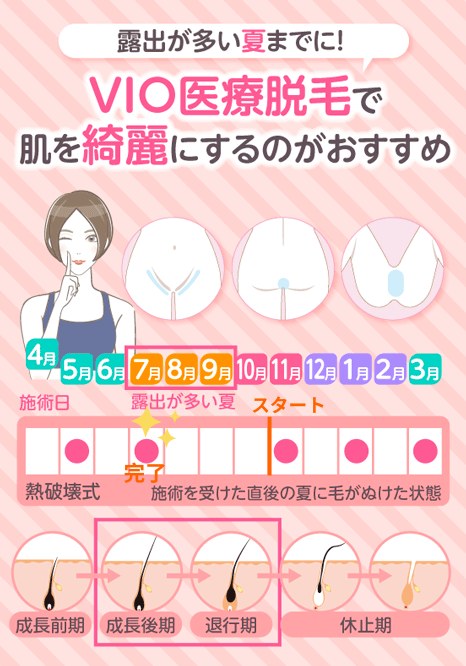 VIO医療脱毛におすすめの時期