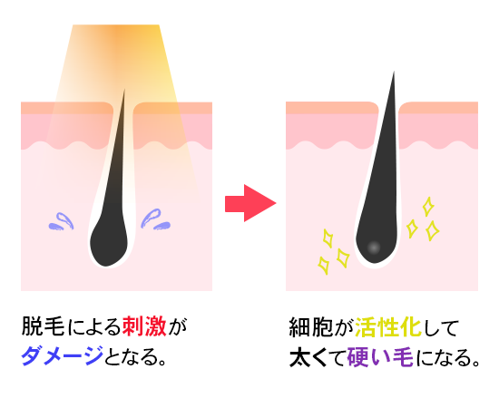 脱毛症の治療法