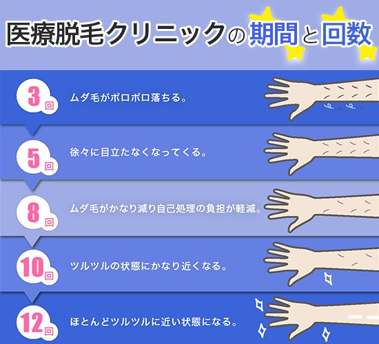 医療脱毛が短期間で終わるクリニックはどれ 期間や目安を比較紹介